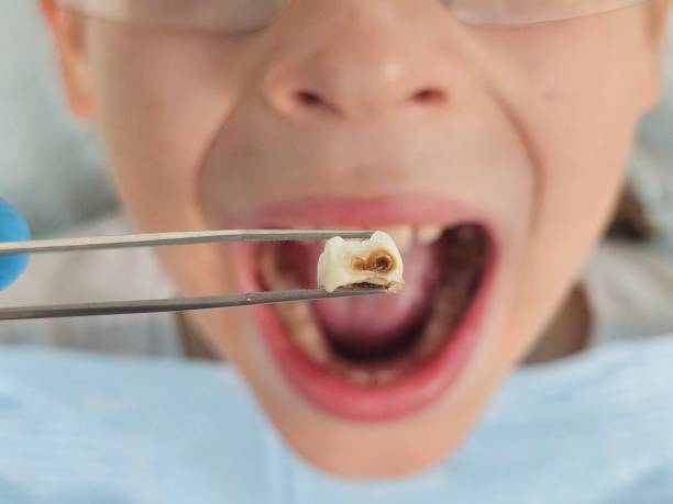 Best Dentist for Dental Trauma  in Melrose Park, IL